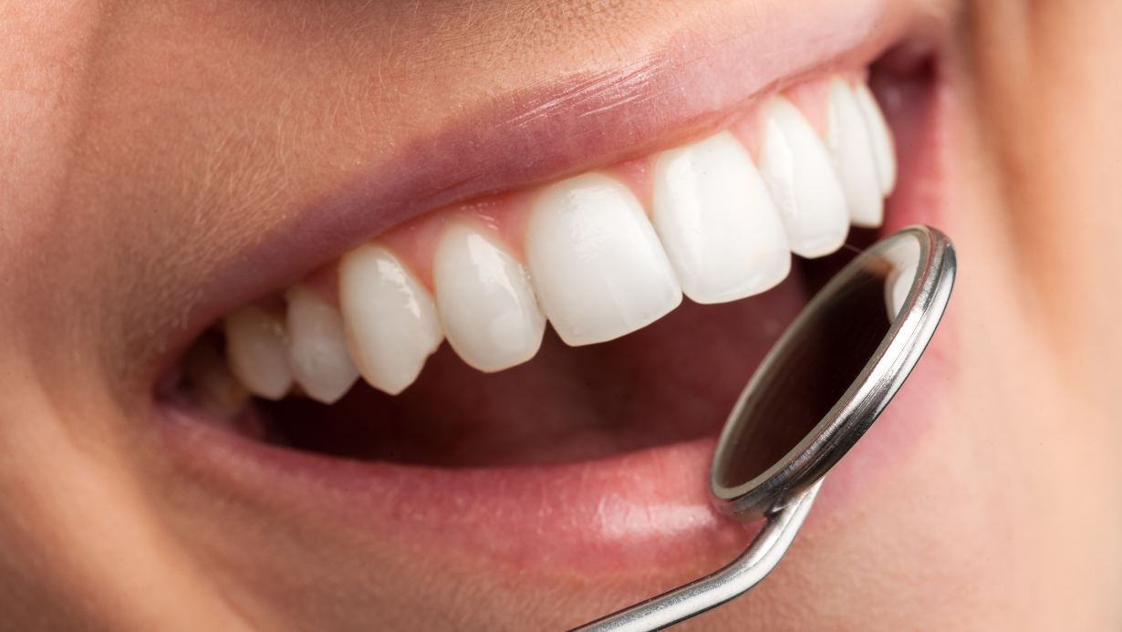 Lee más sobre el artículo Marketing odontológico, el éxito para tu clínica dental